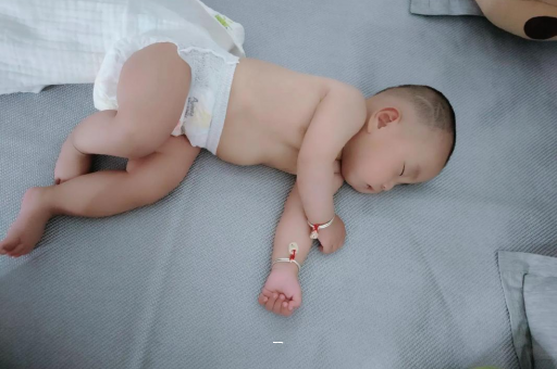 三门峡宝宝脸上有白色斑块